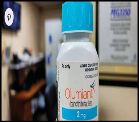 Alopecia: FDA approves Olumiant for hair loss treatment - Pakistan Observer