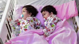 Pakistans Formerly Conjoined Sisters Attend International Conference On Conjoined Twins In Saudi Arabia