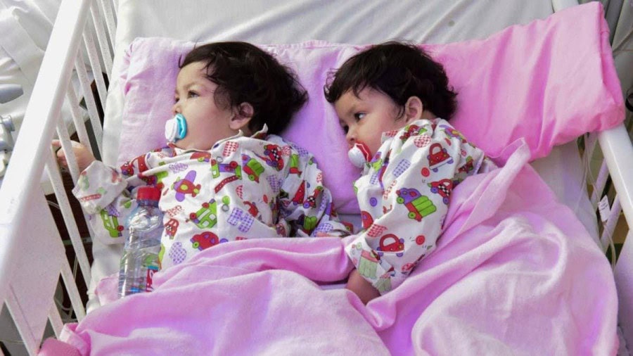 Pakistans Formerly Conjoined Sisters Attend International Conference On Conjoined Twins In Saudi Arabia