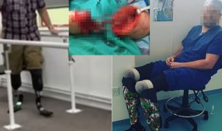 Surgeon Claims Half Million From Insurance After Cutting Off Own Legs