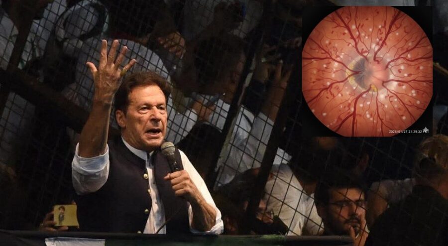 Imran Khan Diagnosed With Potentially Blinding Eye Disease In Adiala Jail