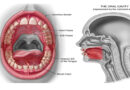 Oral Cavity Cancer Situation In Pakistan And The Role Of Pakistan Atomic Energy Commission