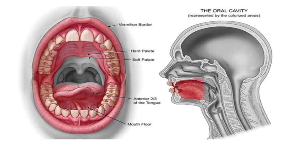 Oral Cavity Cancer Situation In Pakistan And The Role Of Pakistan Atomic Energy Commission