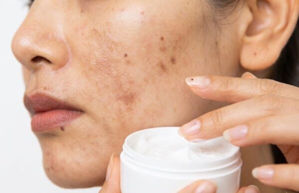 Pakistan Imposes Immediate Ban On 6 Beauty Creams Containing Toxic Ingredients Including Mercury